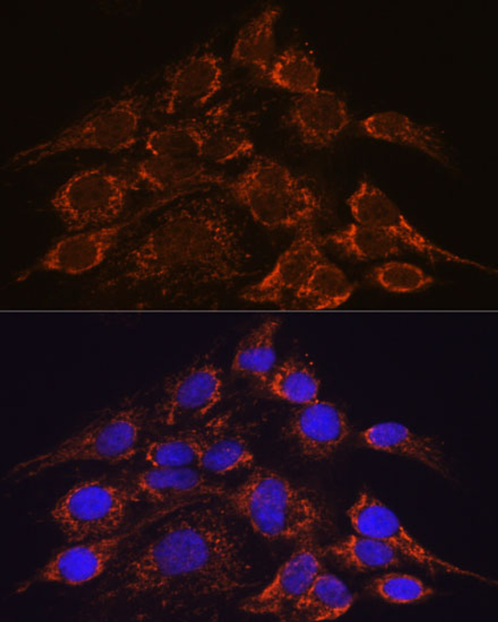 Immunofluorescence analysis of C6 cells using HPS4 Polyclonal Antibody at dilution of  1:100. Blue: DAPI for nuclear staining.