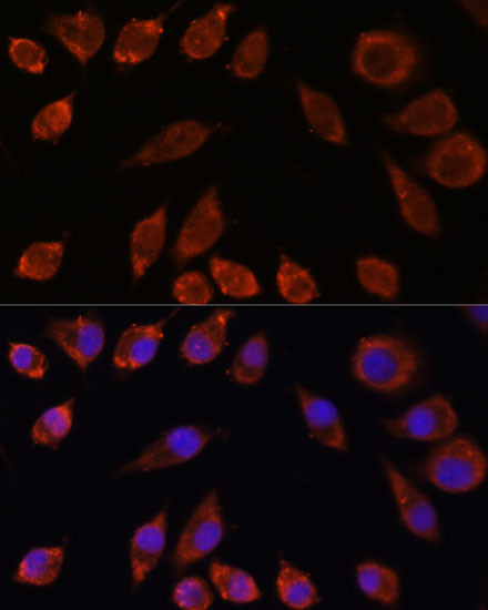 Immunofluorescence analysis of L929 cells using HPS4 Polyclonal Antibody at dilution of  1:100. Blue: DAPI for nuclear staining.