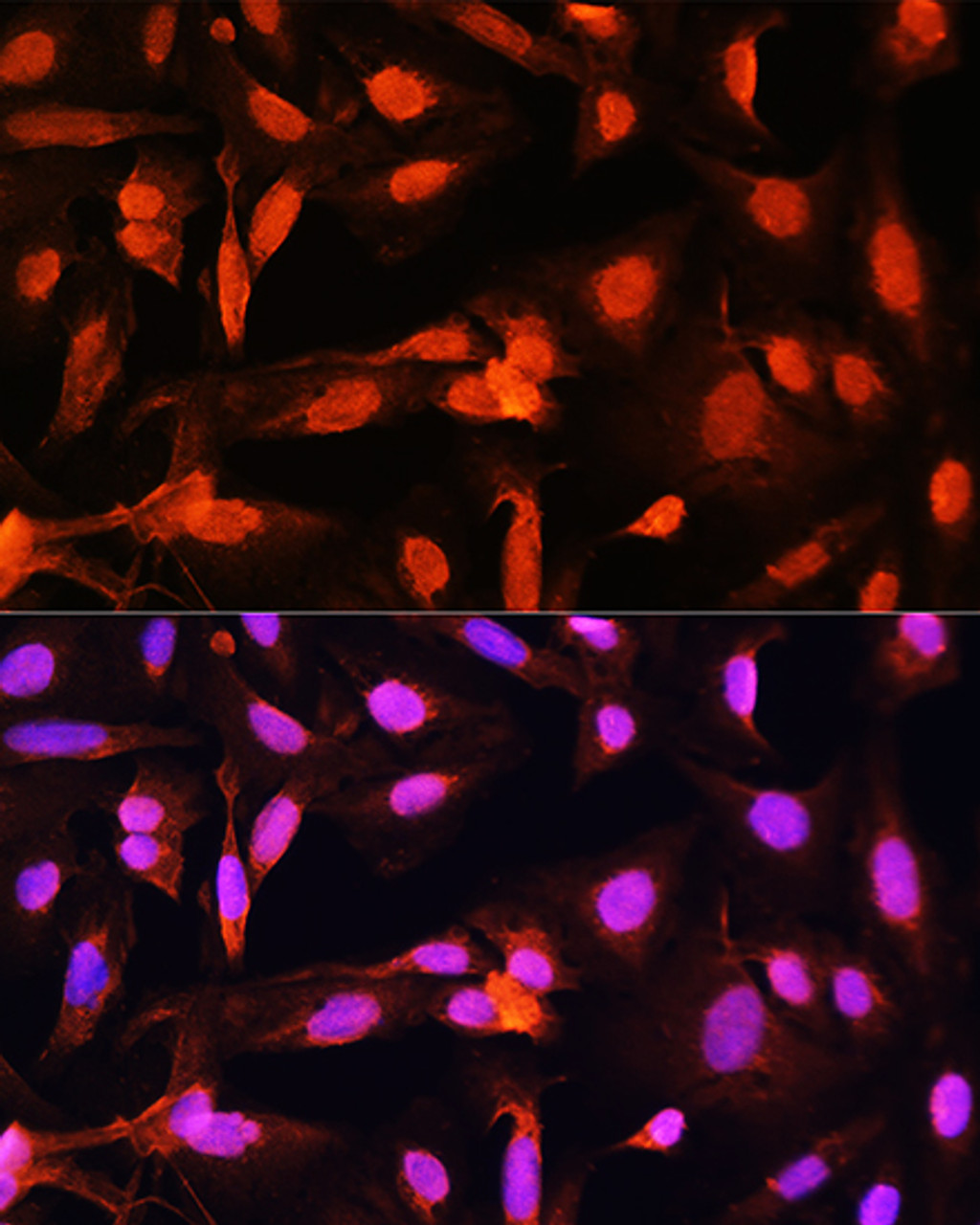 Immunofluorescence analysis of U20S cells using SGOL1 Polyclonal Antibody at dilution of  1:100. Blue: DAPI for nuclear staining.