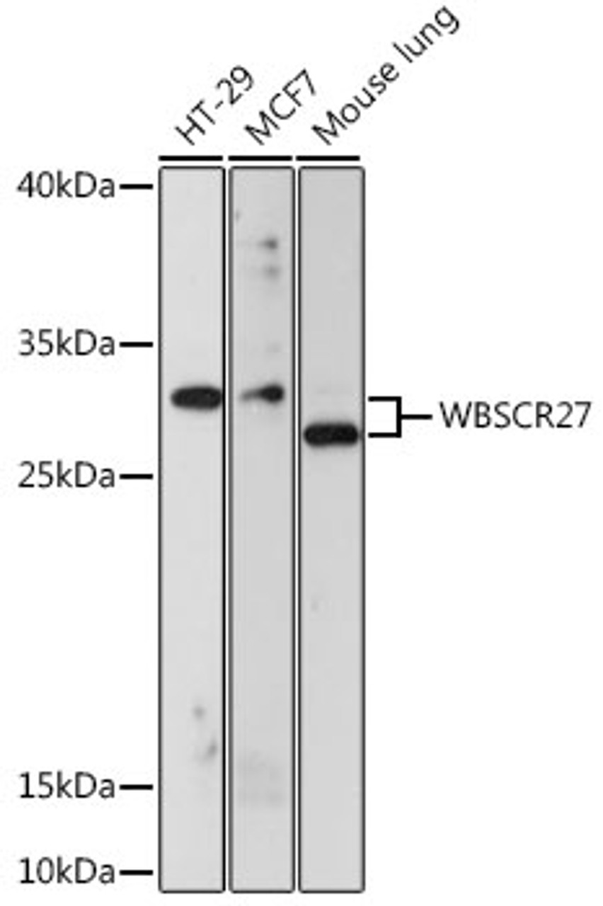 Western blot analysis of extracts of various cell lines using WBSCR27 Polyclonal Antibody at dilution of 1:1000.