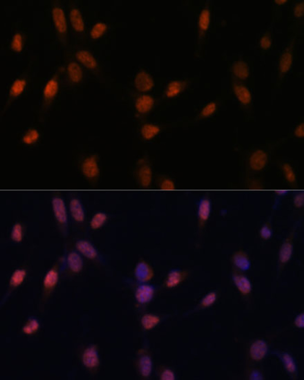 Immunofluorescence analysis of NIH-3T3 cells using USP33 Polyclonal Antibody at dilution of  1:100 (40x lens). Blue: DAPI for nuclear staining.
