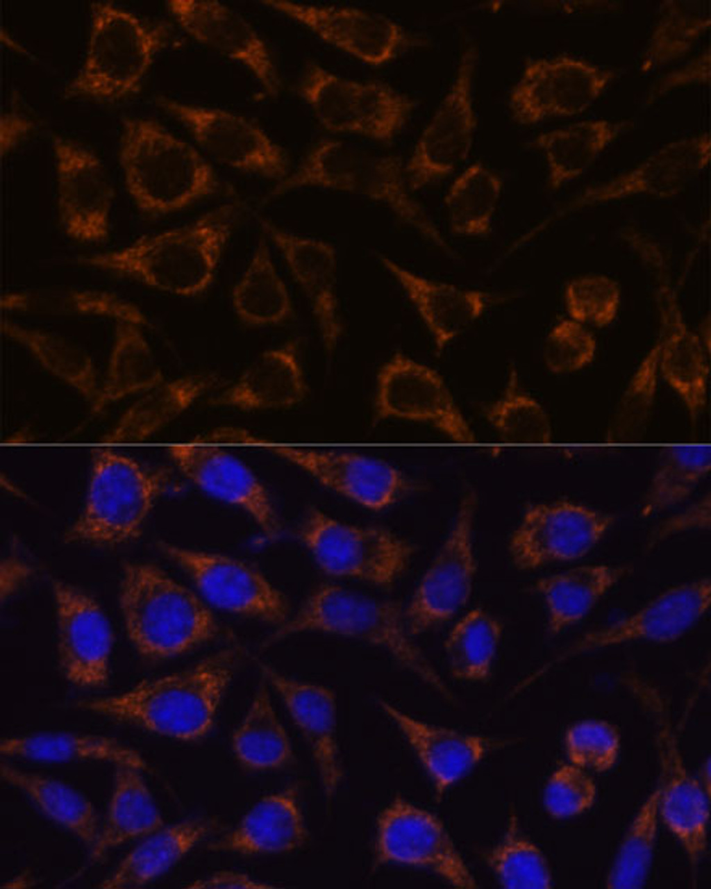 Immunofluorescence analysis of L929 cells using GTPBP8 Polyclonal Antibody at dilution of  1:100. Blue: DAPI for nuclear staining.