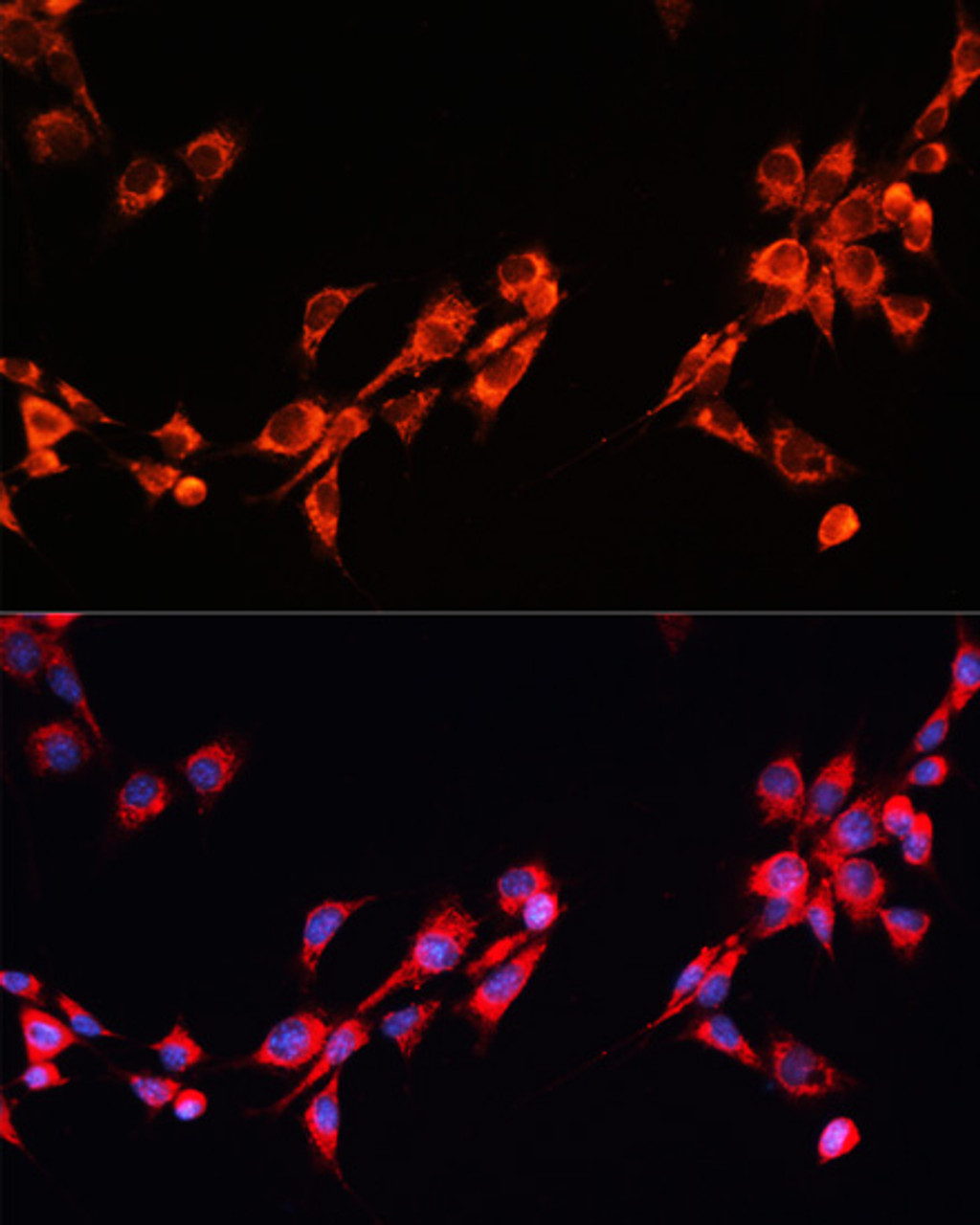 Immunofluorescence analysis of NIH/3T3 cells using PGRMC2 Polyclonal Antibody at dilution of  1:100. Blue: DAPI for nuclear staining.