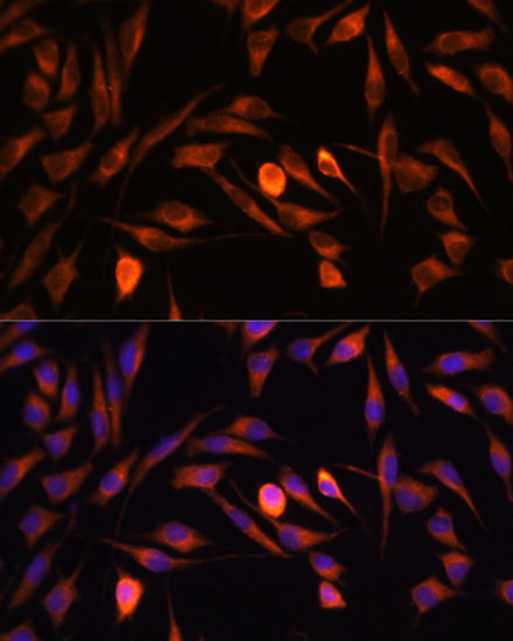 Immunofluorescence analysis of L929 cells using PTCD1 Polyclonal Antibody at dilution of  1:100. Blue: DAPI for nuclear staining.