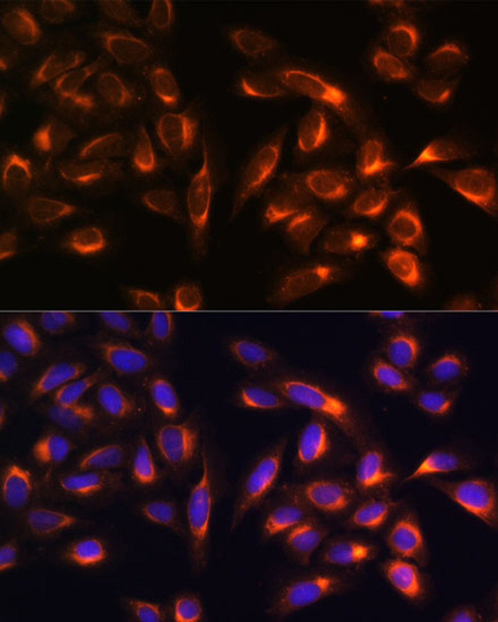 Immunofluorescence analysis of U-2 OS cells using PTCD1 Polyclonal Antibody at dilution of  1:100. Blue: DAPI for nuclear staining.