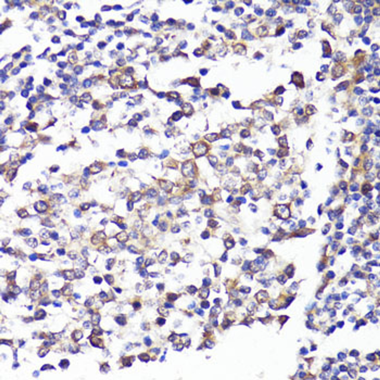 Immunohistochemistry of paraffin-embedded Human tonsil using SELL Polyclonal Antibody at dilution of  1:100 (40x lens).