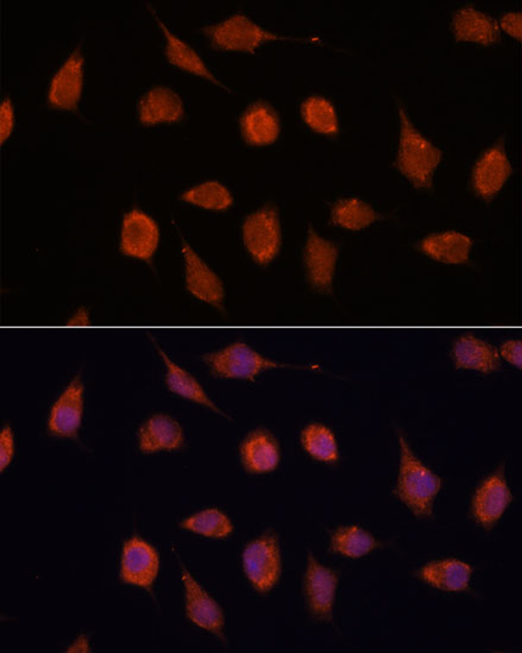 Immunofluorescence analysis of L929 cells using KCNAB2 Polyclonal Antibody at dilution of  1:100. Blue: DAPI for nuclear staining.