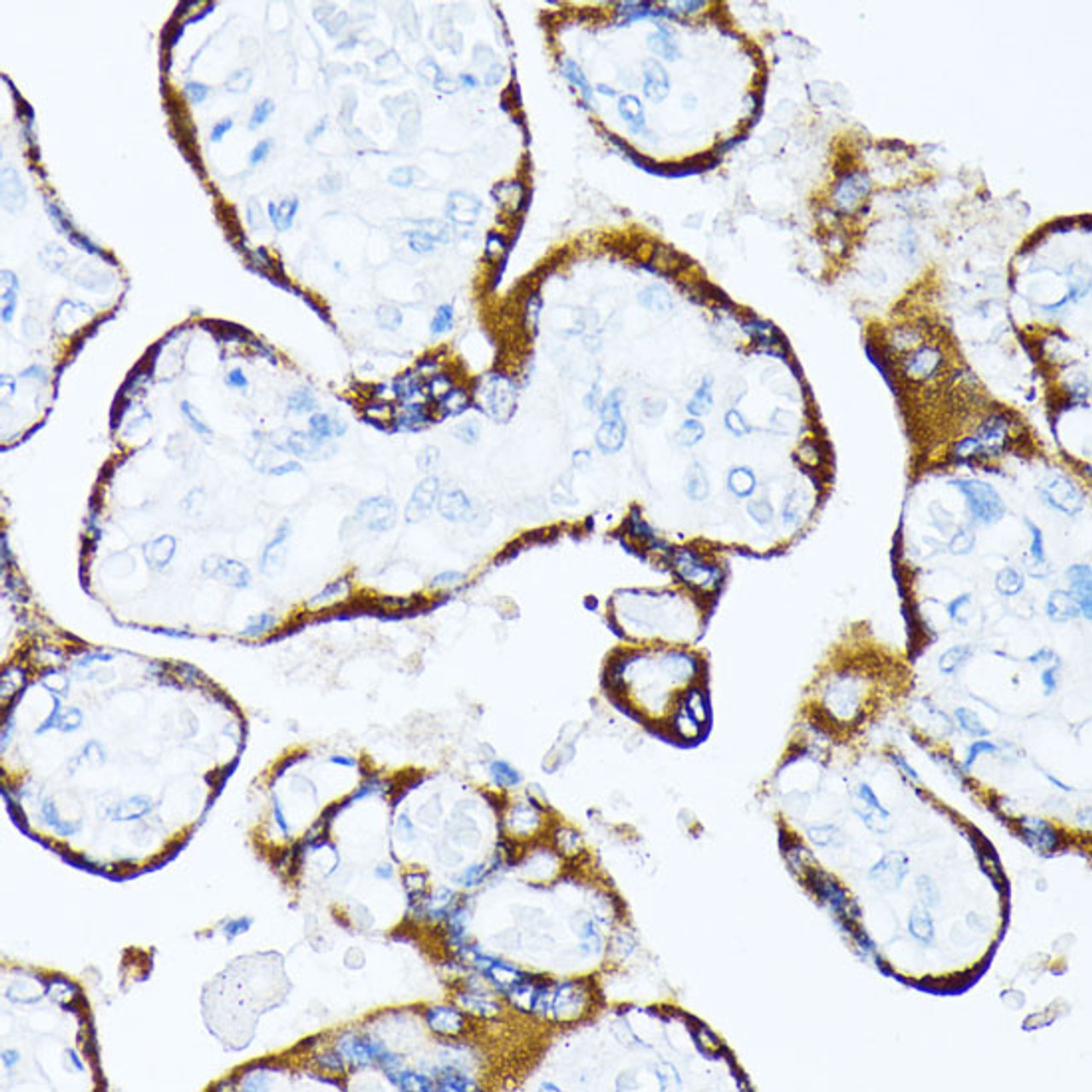 Immunohistochemistry of paraffin-embedded Human placenta using CSNK1A1 Polyclonal Antibody at dilution of  1:100 (40x lens).