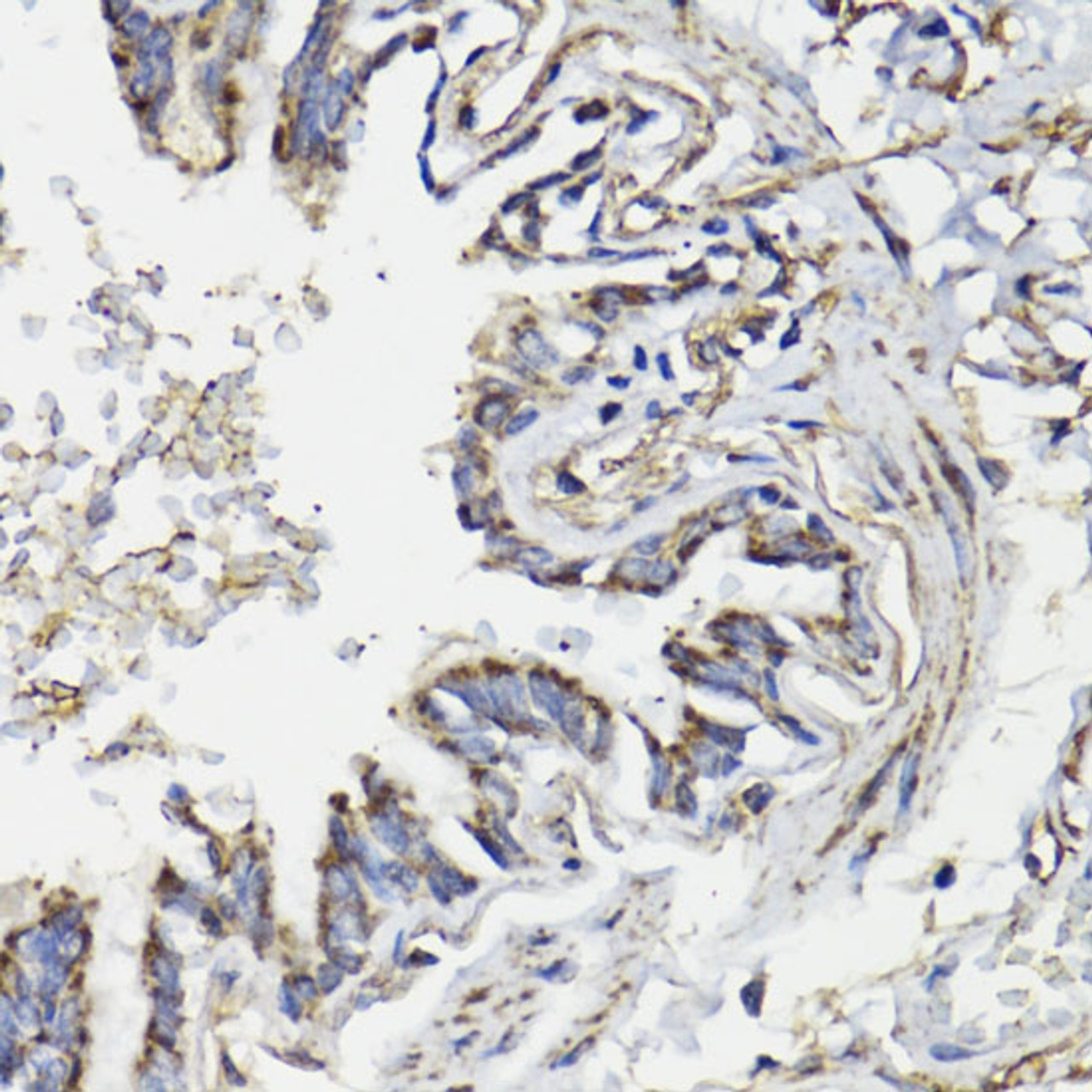 Immunohistochemistry of paraffin-embedded Human lung using WASF3 Polyclonal Antibody at dilution of  1:100 (40x lens).