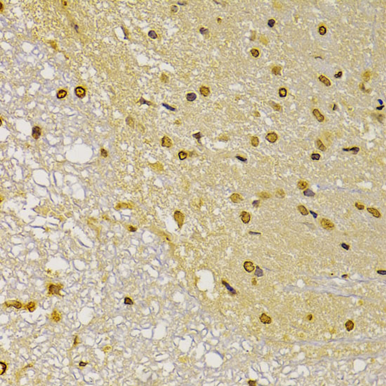 Immunohistochemistry of paraffin-embedded Rat brain using FSP1/S100A4 Polyclonal Antibody at dilution of  1:100 (40x lens).