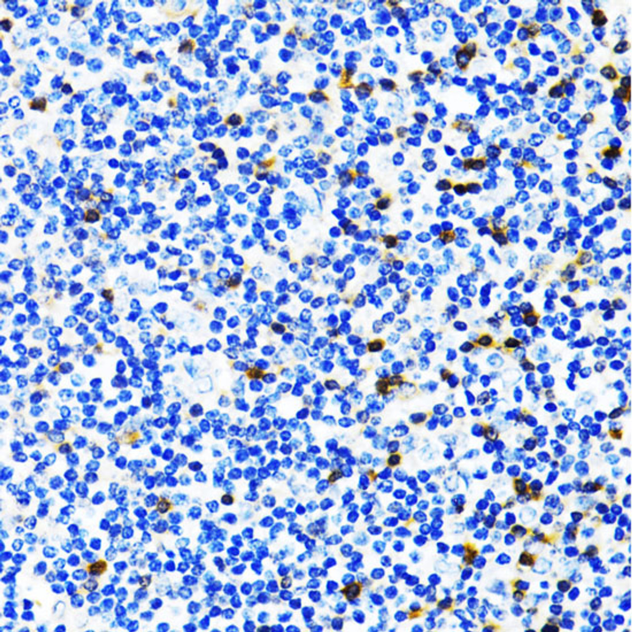 Immunohistochemistry of paraffin-embedded Human tonsil using FSP1/S100A4 Polyclonal Antibody at dilution of  1:100 (40x lens).