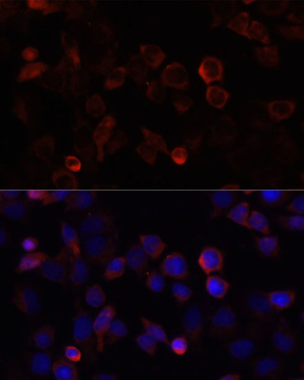 Immunofluorescence analysis of HeLa cells using FSP1/S100A4 Polyclonal Antibody at dilution of  1:100. Blue: DAPI for nuclear staining.