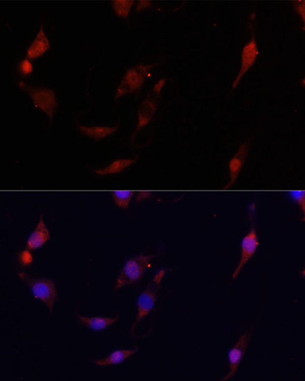 Immunofluorescence analysis of PC12 cells using FSP1/S100A4 Polyclonal Antibody at dilution of  1:100. Blue: DAPI for nuclear staining.