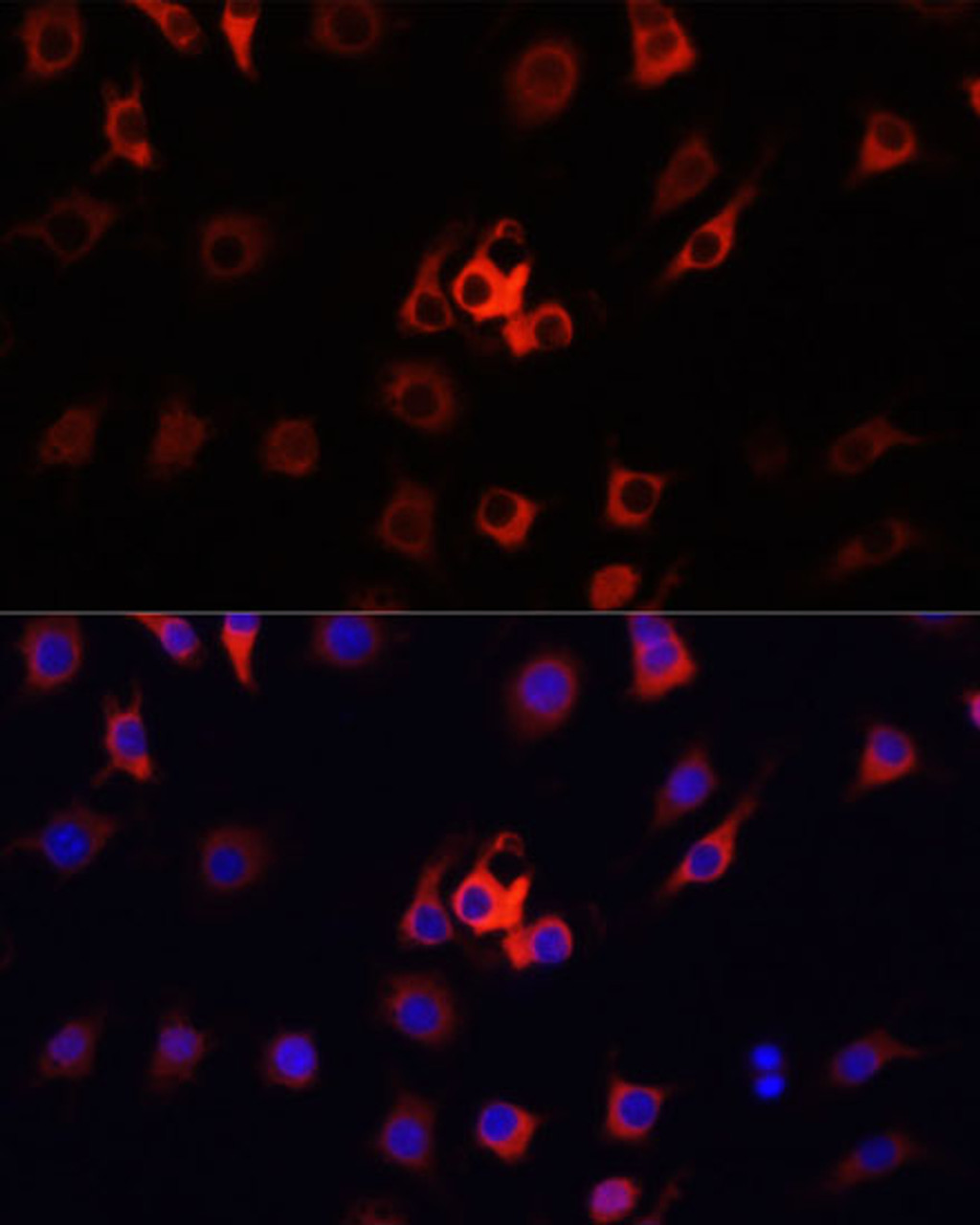 Immunofluorescence analysis of RAW264.7 cells using FSP1/S100A4 Polyclonal Antibody at dilution of  1:100. Blue: DAPI for nuclear staining.