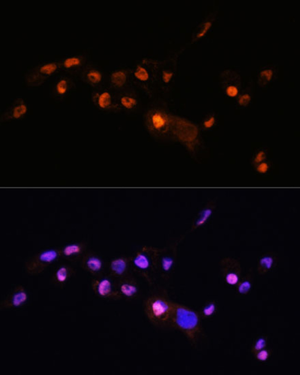 Immunofluorescence analysis of A431 cells using KLF8 Polyclonal Antibody at dilution of  1:100. Blue: DAPI for nuclear staining.