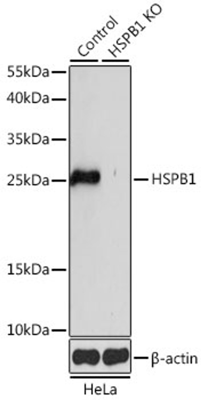 Western blot analysis of extracts from normal (control) and HSPB1 knockout (KO) HeLa cells using HSPB1 Polyclonal Antibody at dilution of 1:1000.