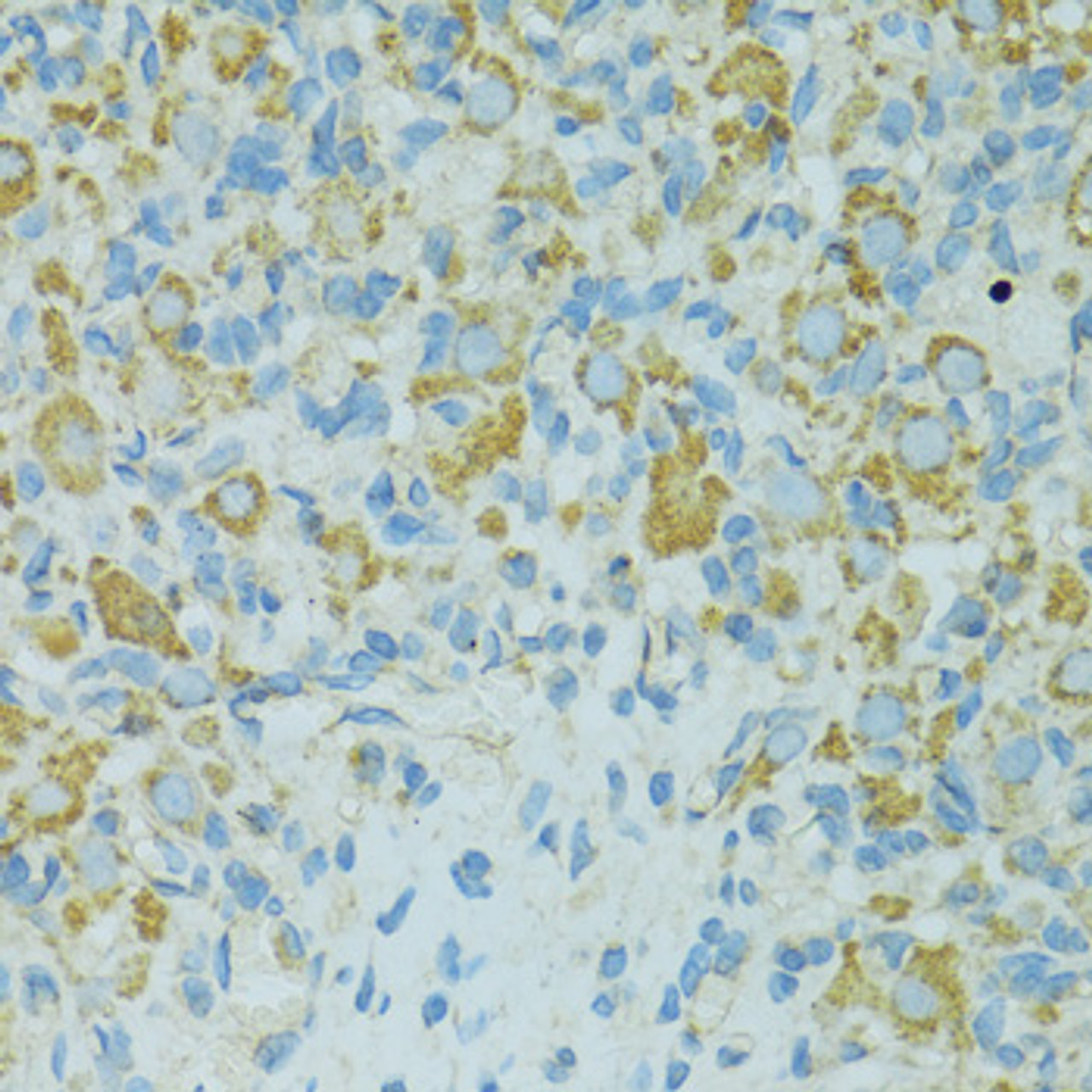 Immunohistochemistry of paraffin-embedded Rat ovary using HSPB1 Polyclonal Antibody at dilution of  1:100 (40x lens).
