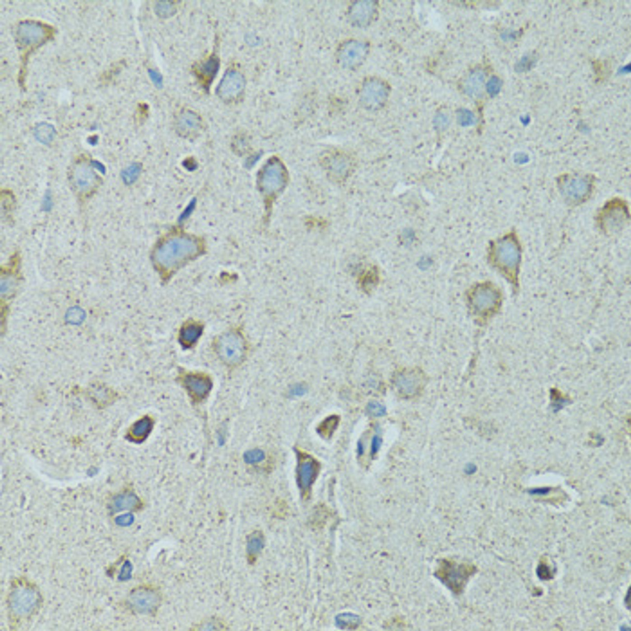 Immunohistochemistry of paraffin-embedded Rat brain using HSPB1 Polyclonal Antibody at dilution of  1:100 (40x lens).
