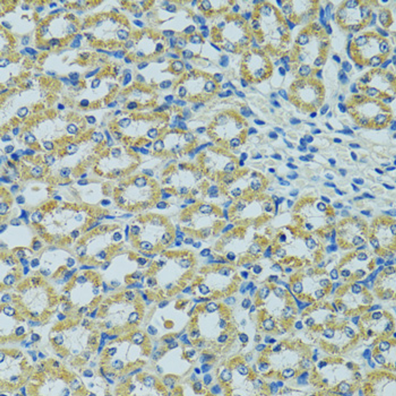 Immunohistochemistry of paraffin-embedded Mouse kidney using HSPB1 Polyclonal Antibody at dilution of  1:100 (40x lens).