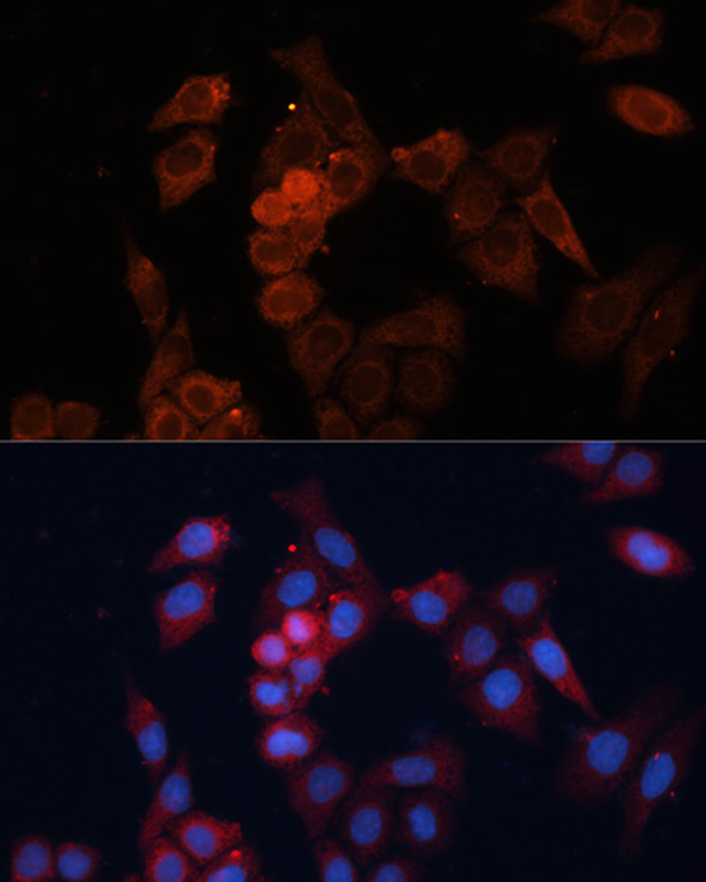 Immunofluorescence analysis of HeLa cells using HSPB1 Polyclonal Antibody at dilution of  1:100. Blue: DAPI for nuclear staining.