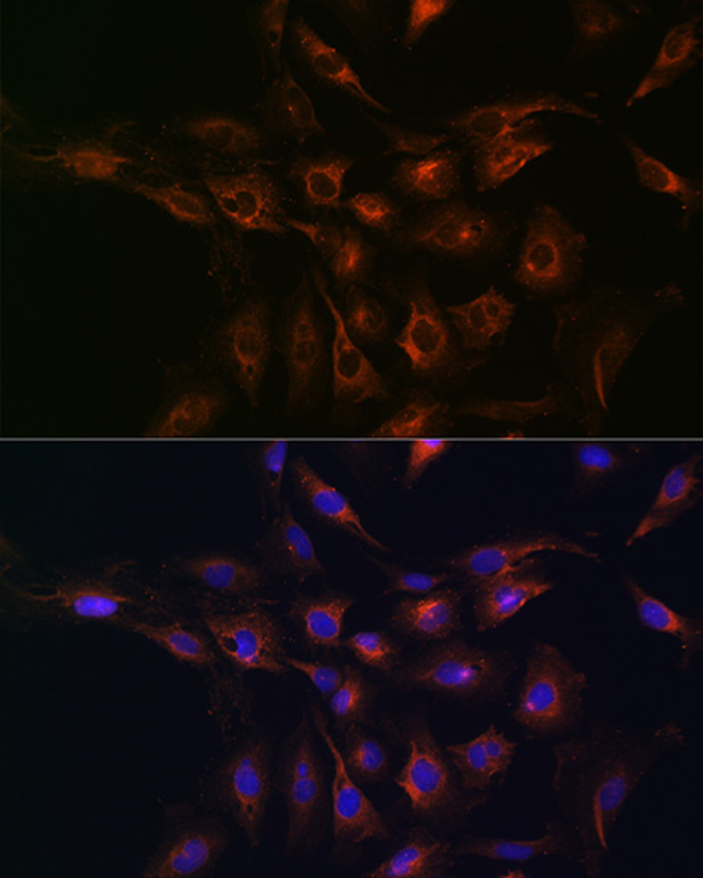 Immunofluorescence analysis of C6 cells using ABCA1 Polyclonal Antibody at dilution of  1:100 (40x lens). Blue: DAPI for nuclear staining.