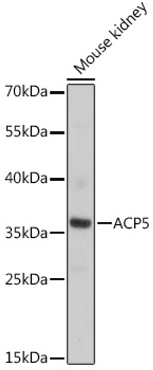 Western blot analysis of extracts of Mouse kidney using ACP5 Polyclonal Antibody at dilution of 1:1000.