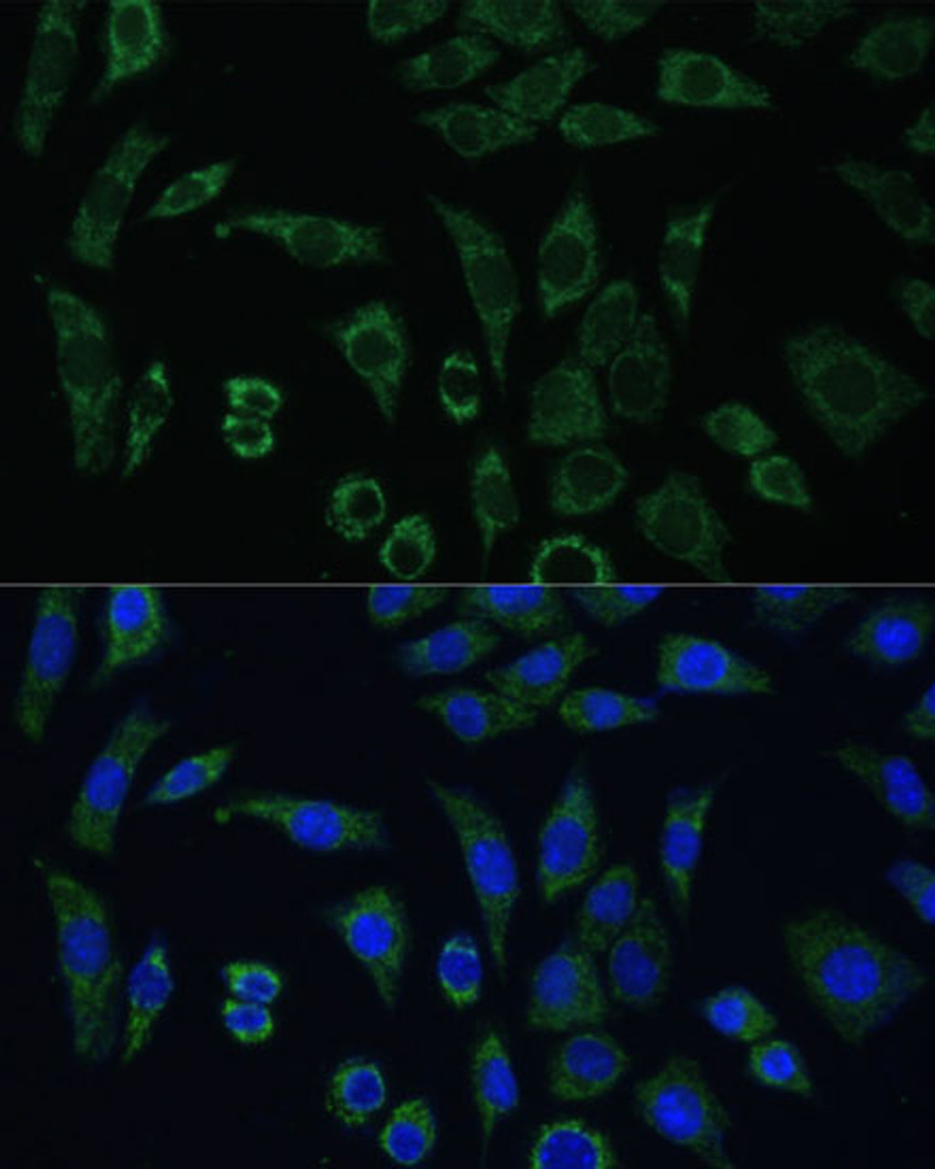 Immunofluorescence analysis of L929 cells using AEBP1 Polyclonal Antibody at dilution of  1:100 (40x lens). Blue: DAPI for nuclear staining.