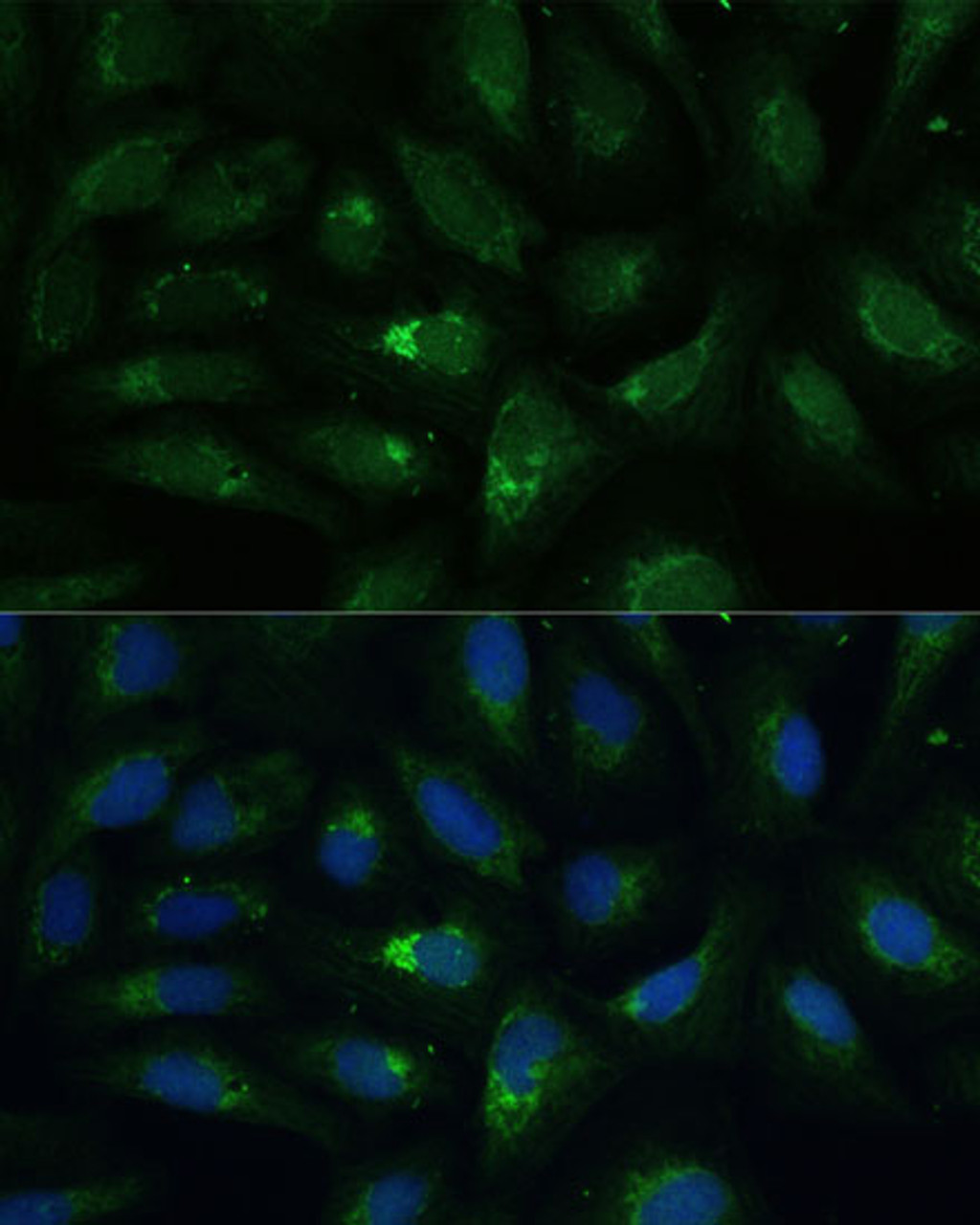Immunofluorescence analysis of U-2 OS cells using AEBP1 Polyclonal Antibody at dilution of  1:100 (40x lens). Blue: DAPI for nuclear staining.