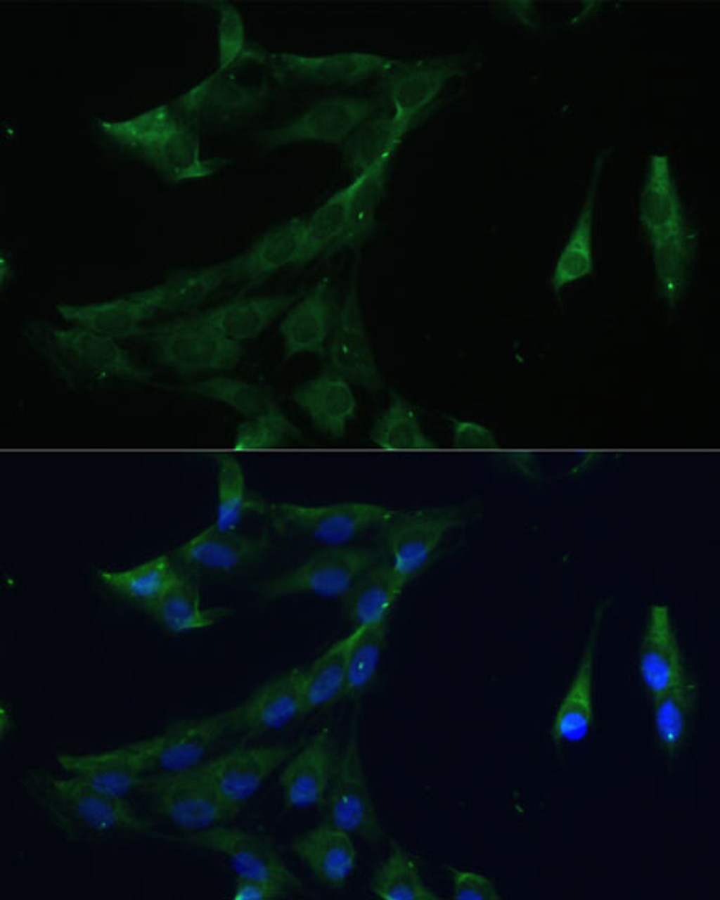 Immunofluorescence analysis of C6 cells using ARL3 Polyclonal Antibody at dilution of  1:100 (40x lens). Blue: DAPI for nuclear staining.