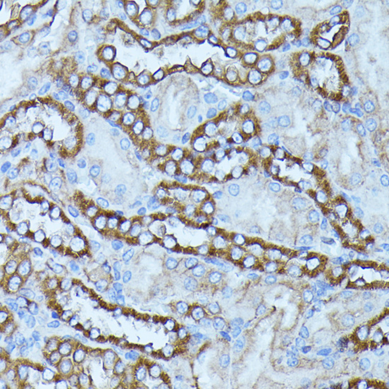 Immunohistochemistry of paraffin-embedded Rat kidney using FGD1 Polyclonal Antibody at dilution of  1:100 (40x lens).