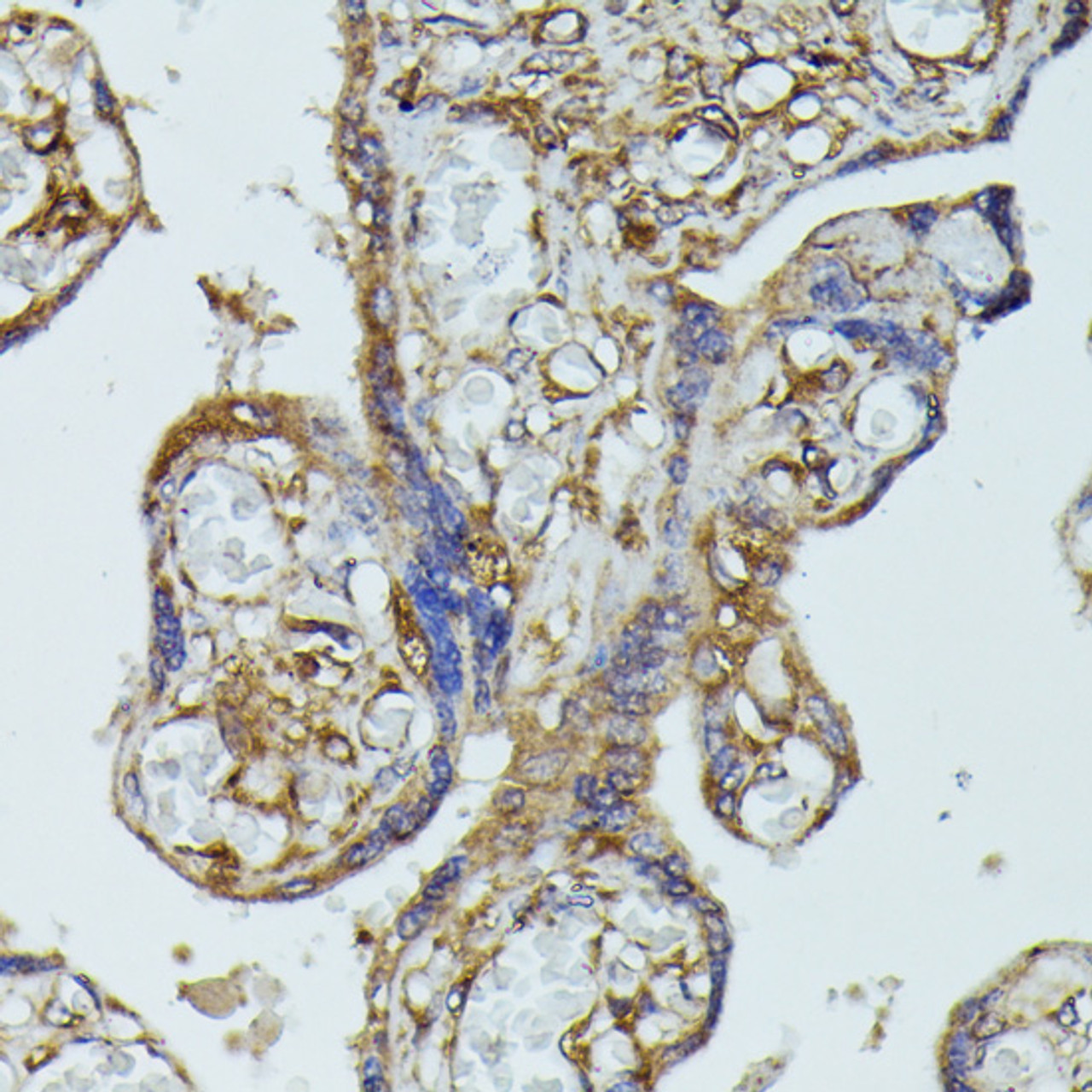 Immunohistochemistry of paraffin-embedded Human placenta using FGD1 Polyclonal Antibody at dilution of  1:100 (40x lens).