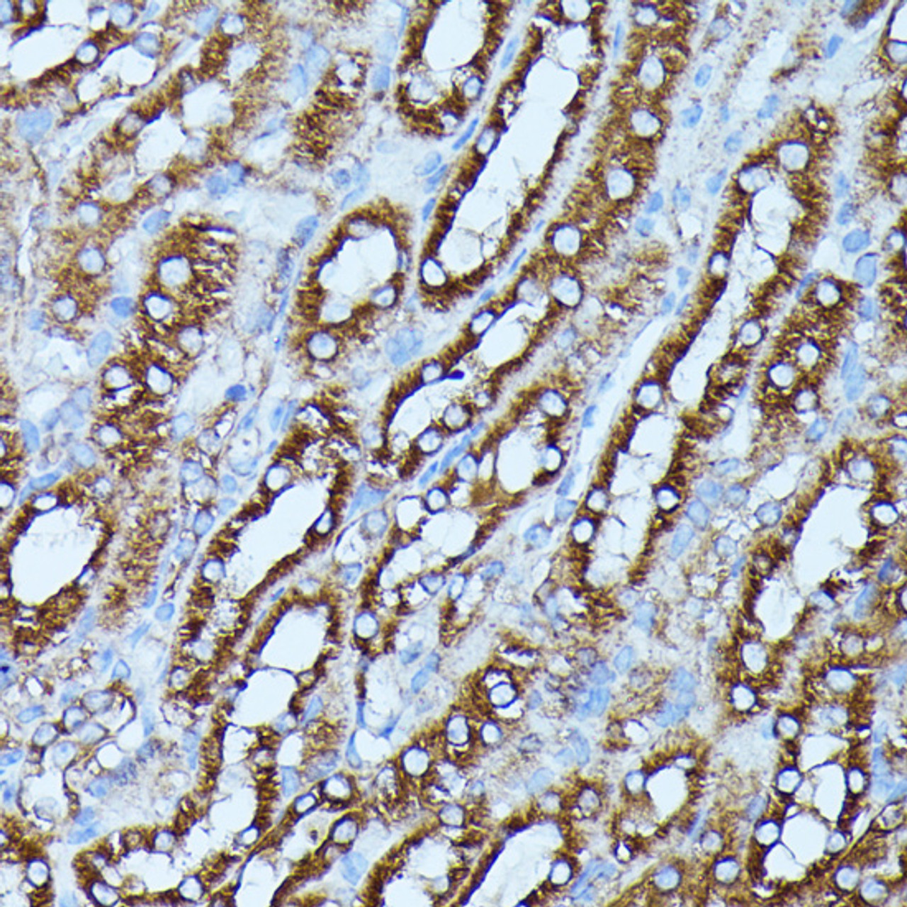 Immunohistochemistry of paraffin-embedded Mouse kidney using FGD1 Polyclonal Antibody at dilution of  1:100 (40x lens).