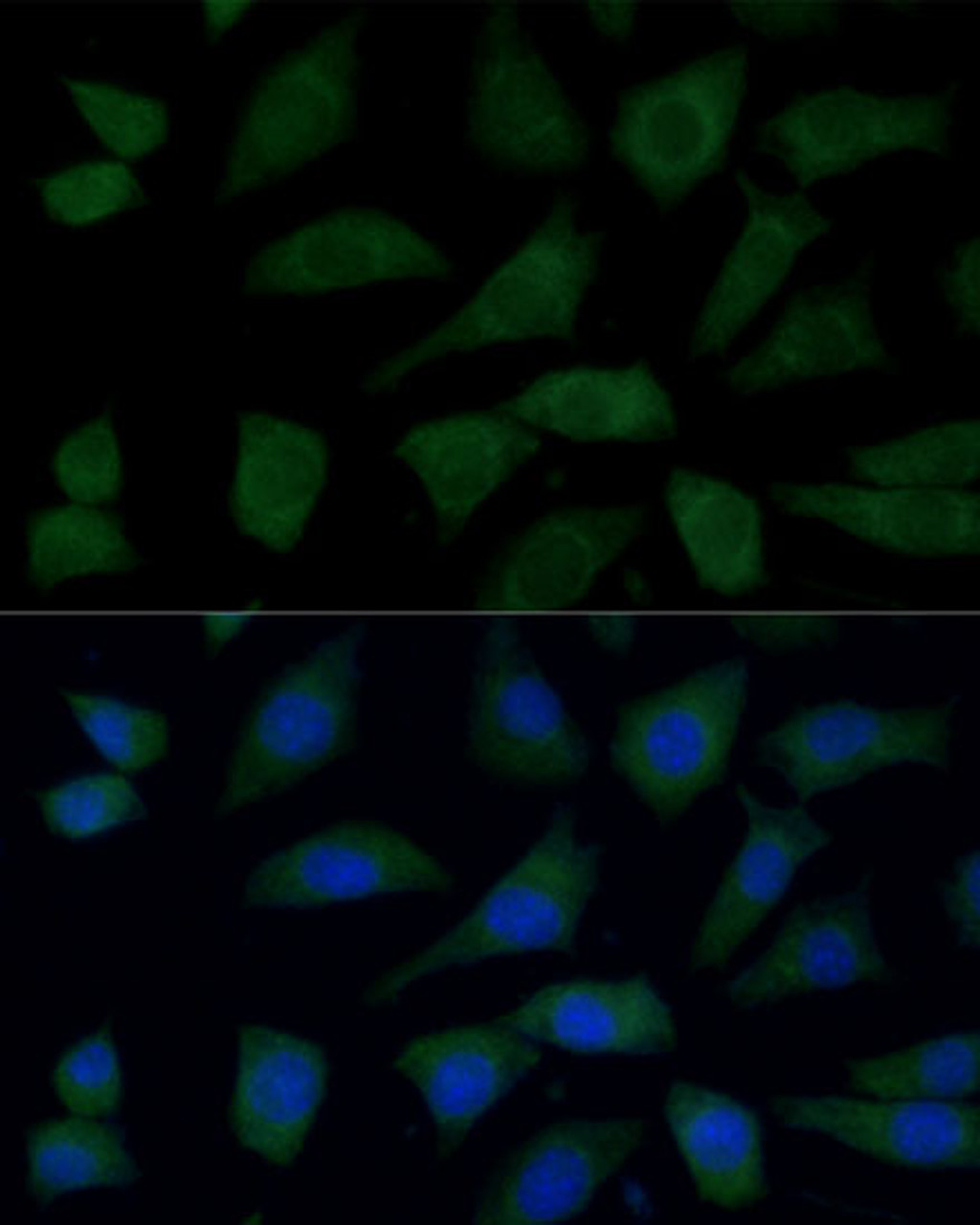 Immunofluorescence analysis of L929 cells using FGD1 Polyclonal Antibody at dilution of  1:100 (40x lens). Blue: DAPI for nuclear staining.