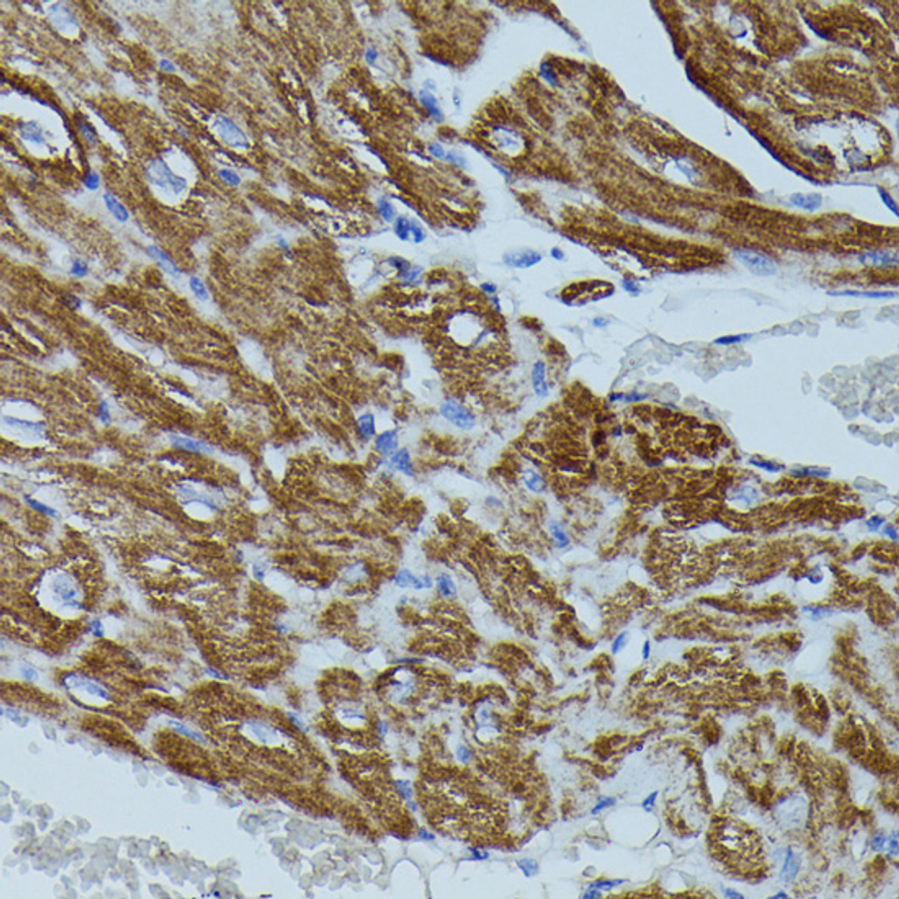 Immunohistochemistry of paraffin-embedded Mouse heart using FKBP1B Polyclonal Antibody at dilution of  1:100 (40x lens).