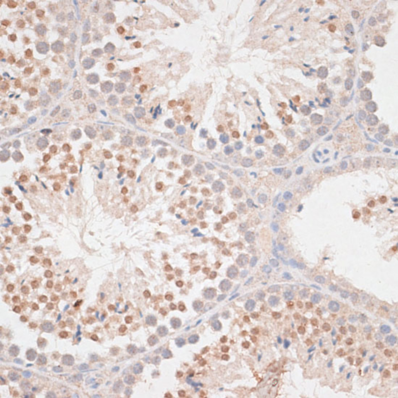 Immunohistochemistry of paraffin-embedded Mouse testis using MAD2L1 Polyclonal Antibody at dilution of  1:100 (40x lens).