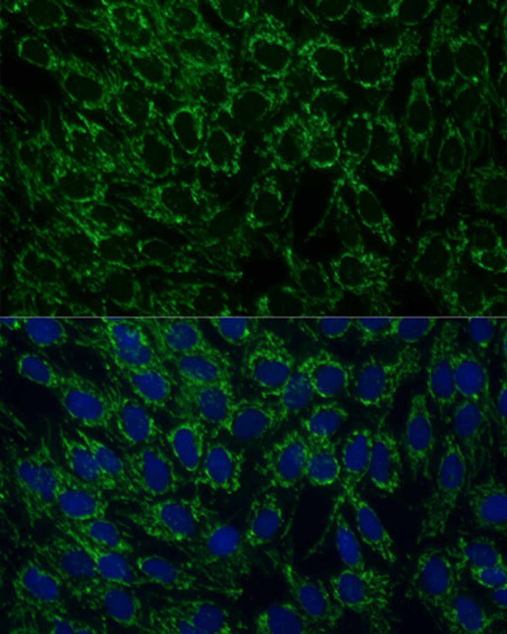 Immunofluorescence analysis of C6 cells using MTIF2 Polyclonal Antibody at dilution of  1:100 (40x lens). Blue: DAPI for nuclear staining.
