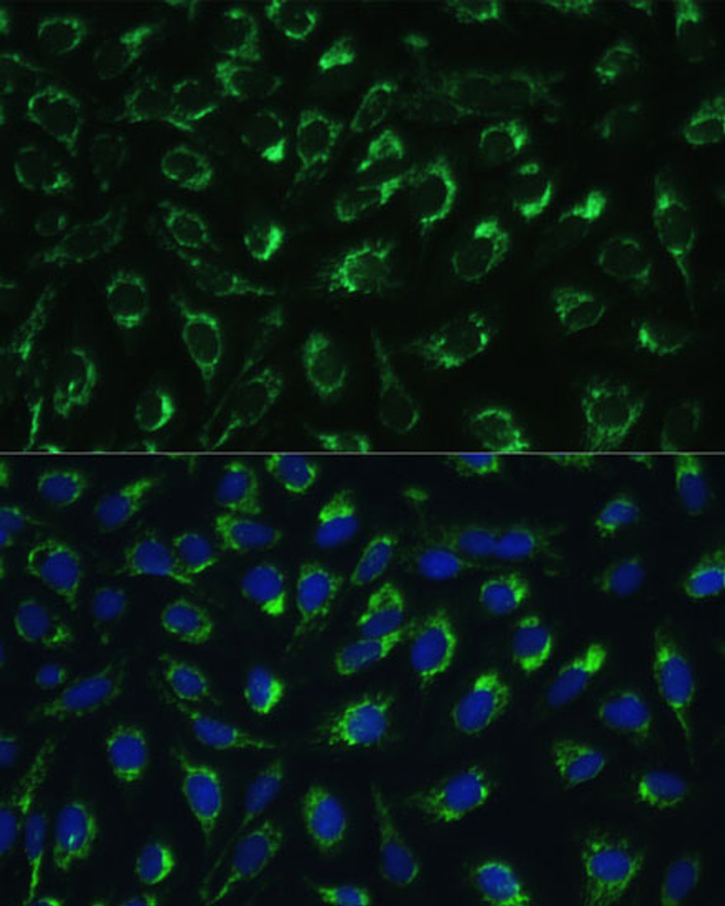 Immunofluorescence analysis of U-2 OS cells using MTIF2 Polyclonal Antibody at dilution of  1:100 (40x lens). Blue: DAPI for nuclear staining.