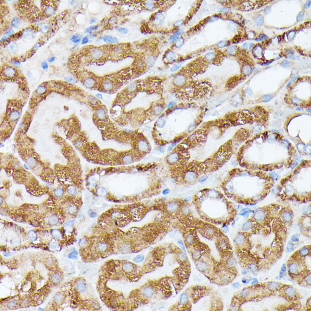 Immunohistochemistry of paraffin-embedded Mouse kidney using NUBP1 Polyclonal Antibody at dilution of  1:100 (40x lens).