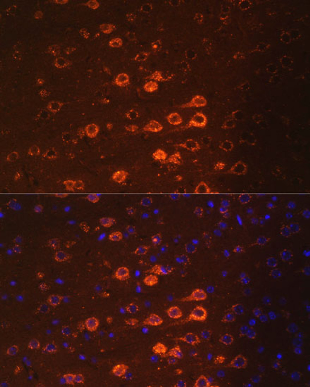 Immunofluorescence analysis of Mouse brain using NEFM Polyclonal Antibody at dilution of  1:100. Blue: DAPI for nuclear staining.