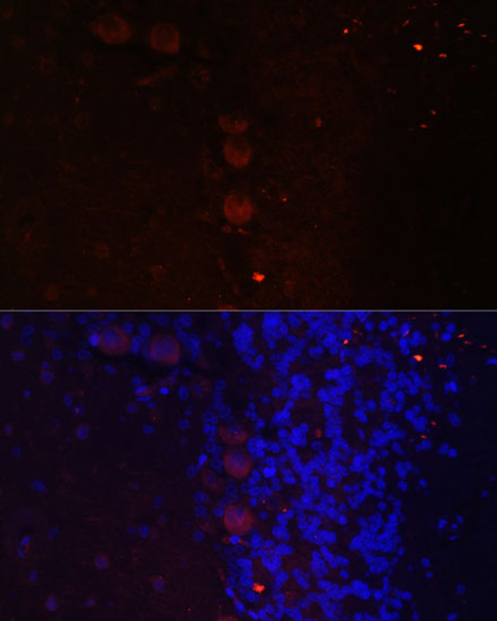 Immunofluorescence analysis of Rat brain using NEFM Polyclonal Antibody at dilution of  1:100. Blue: DAPI for nuclear staining.