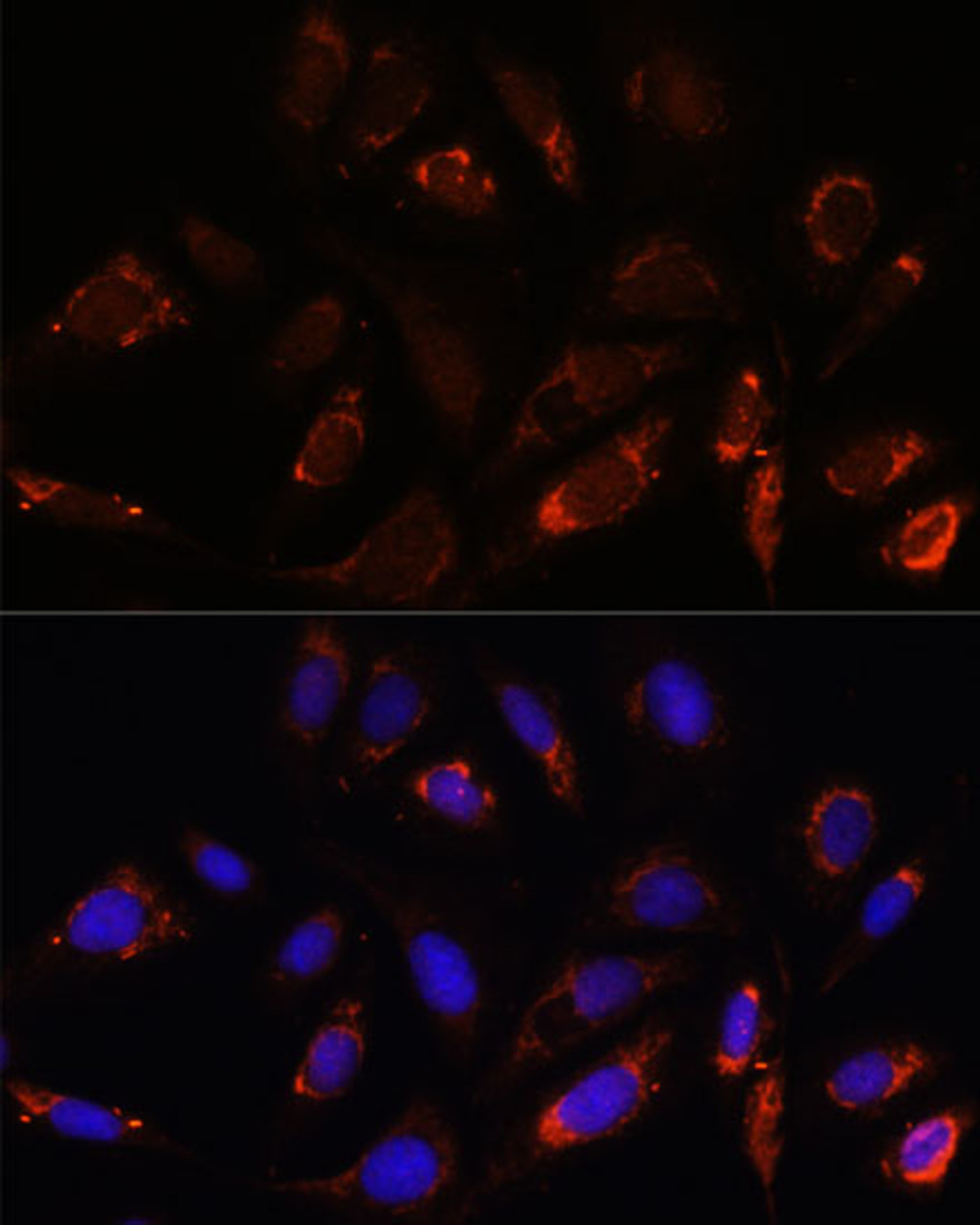 Immunofluorescence analysis of U-2 OS cells using MRPL23 Polyclonal Antibody at dilution of  1:100. Blue: DAPI for nuclear staining.