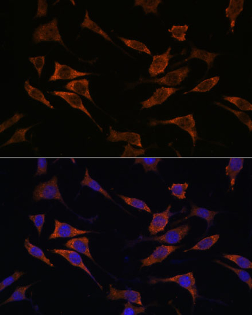 Immunofluorescence analysis of L929 cells using RPS17 Polyclonal Antibody at dilution of  1:100. Blue: DAPI for nuclear staining.