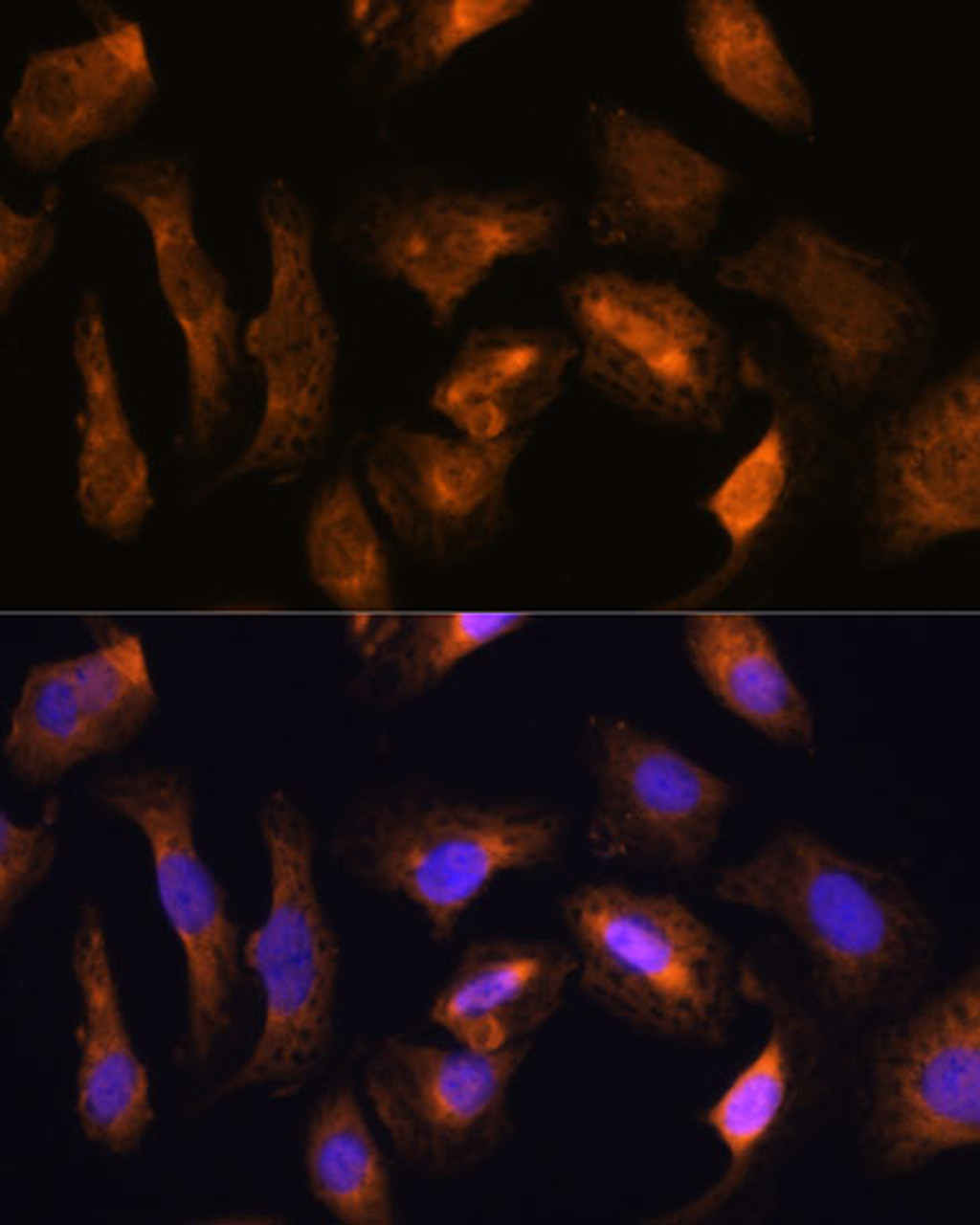 Immunofluorescence analysis of U-2 OS cells using RPS17 Polyclonal Antibody at dilution of  1:100. Blue: DAPI for nuclear staining.