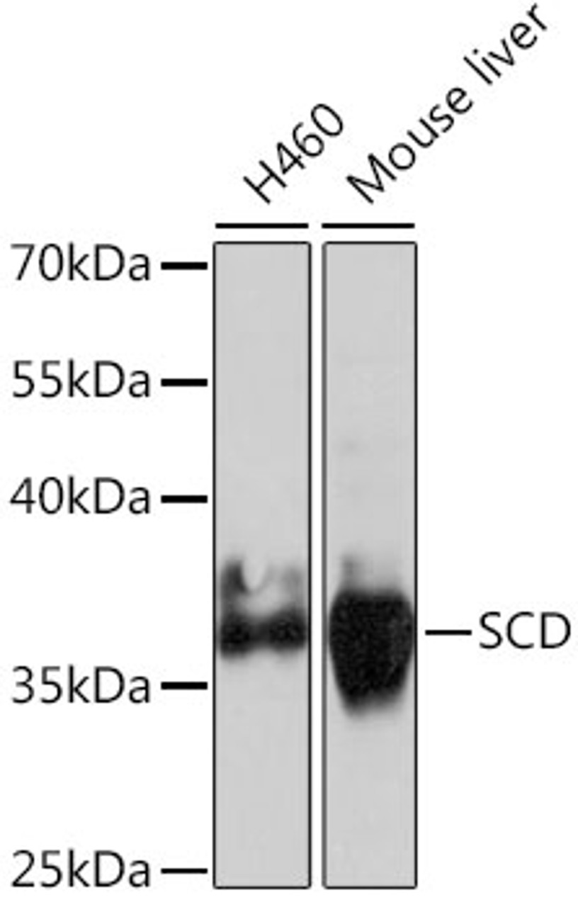 Western blot analysis of extracts of various cell lines using SCD Polyclonal Antibody at dilution of 1:1000.