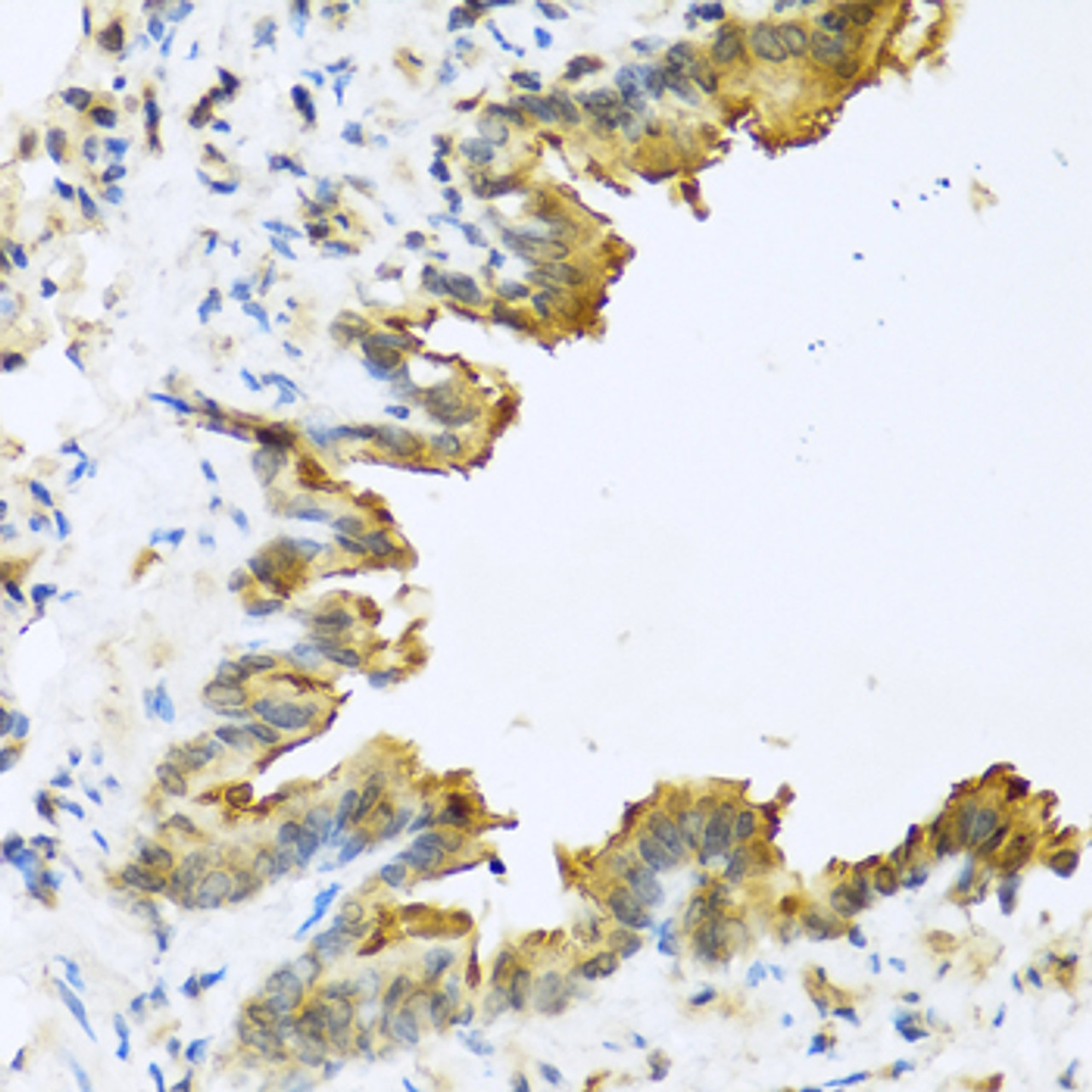 Immunohistochemistry of paraffin-embedded Mouse lung using DEFB4A Polyclonal Antibody at dilution of  1:100 (40x lens).
