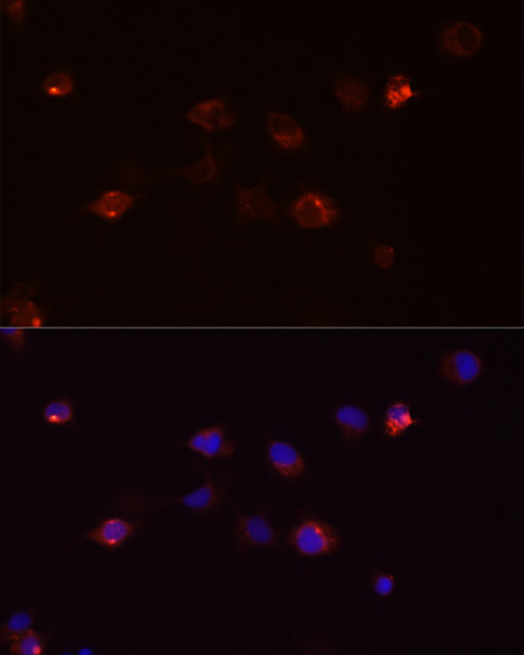 Immunofluorescence analysis of A431 cells using DEFB4A Polyclonal Antibody at dilution of  1:100 (40x lens). Blue: DAPI for nuclear staining.