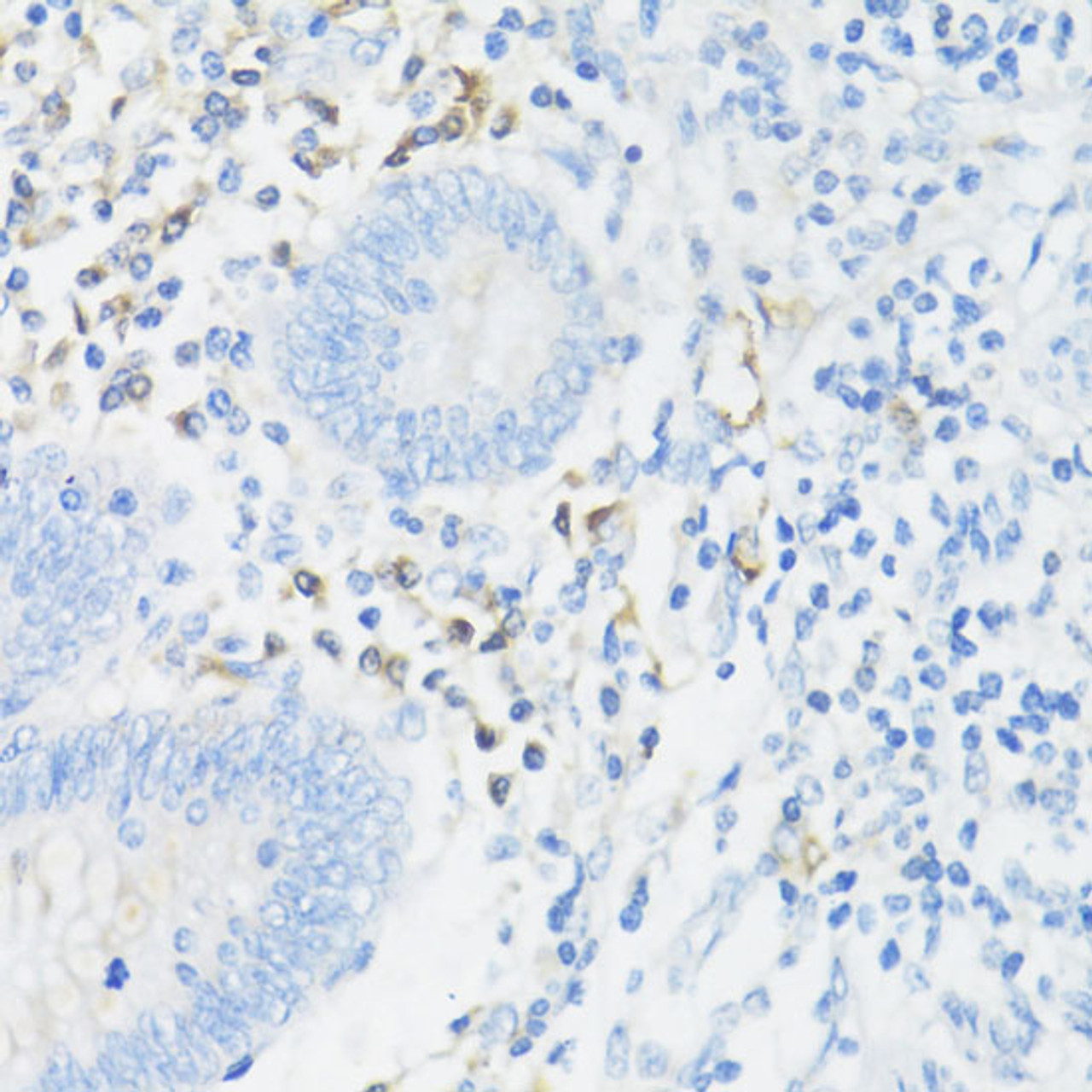 Immunohistochemistry of paraffin-embedded Human appendix using CD11A Polyclonal Antibody at dilution of  1:100 (40x lens).