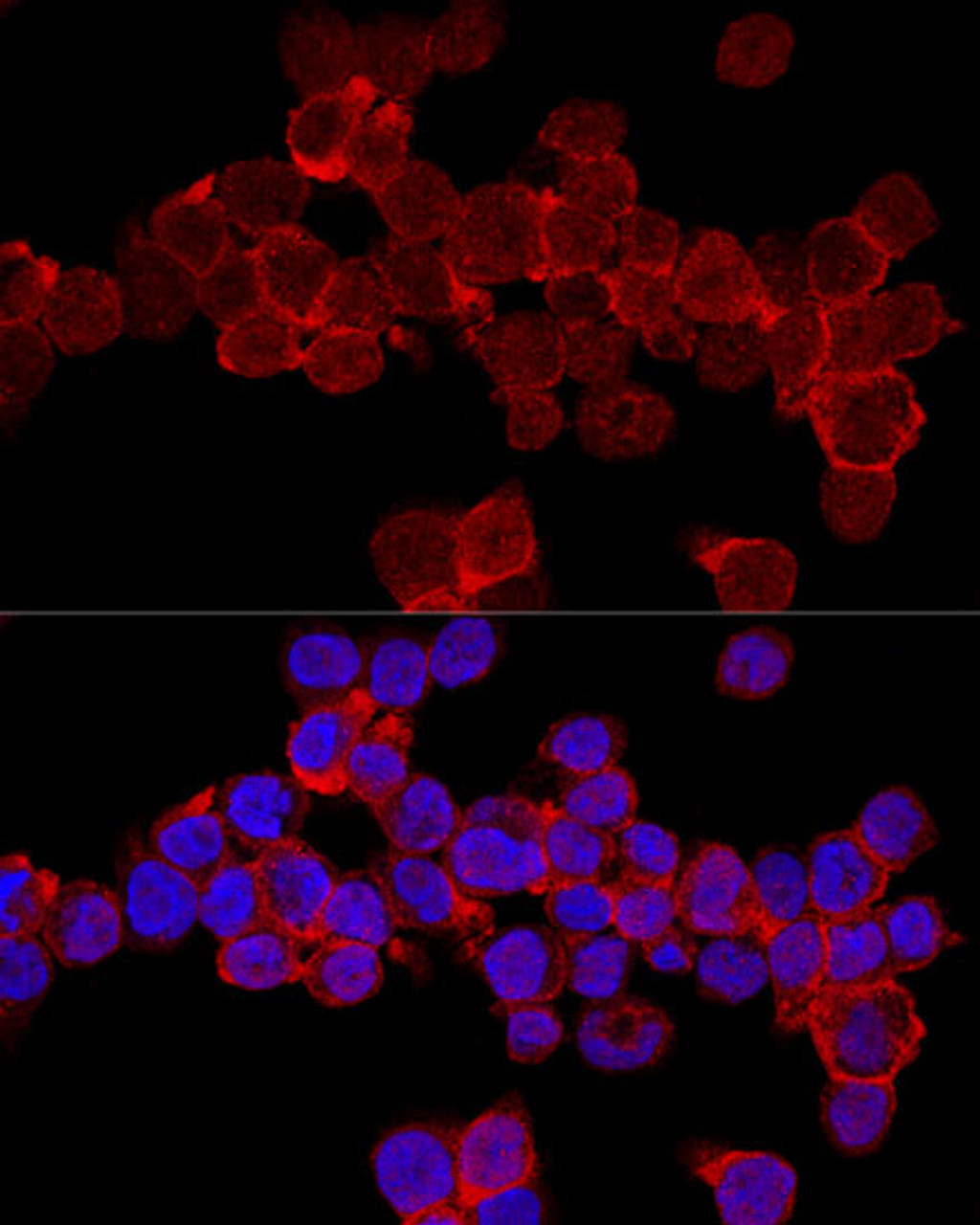 Confocal immunofluorescence analysis of THP-1 cells using CD11A Polyclonal Antibody at dilution of  1:200. Blue: DAPI for nuclear staining.