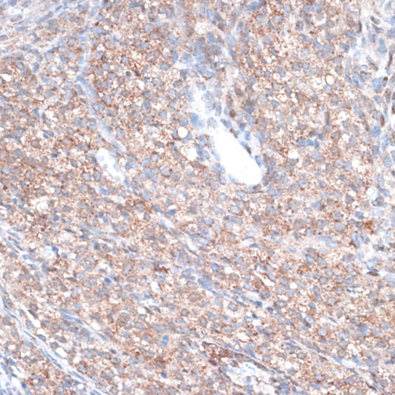 Immunohistochemistry of paraffin-embedded Rat ovary using PLAA Polyclonal Antibody at dilution of  1:100 (40x lens).