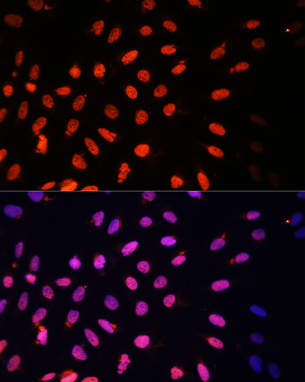 Immunofluorescence analysis of U2OS cells using KLF2 Polyclonal Antibody at dilution of  1:100. Blue: DAPI for nuclear staining.